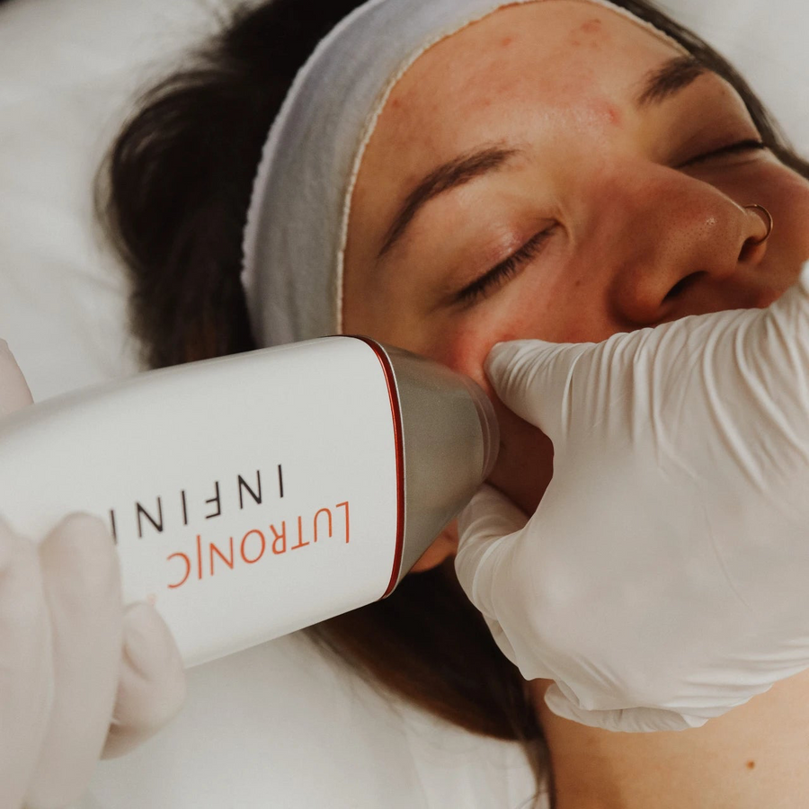 Infini RF Microneedling