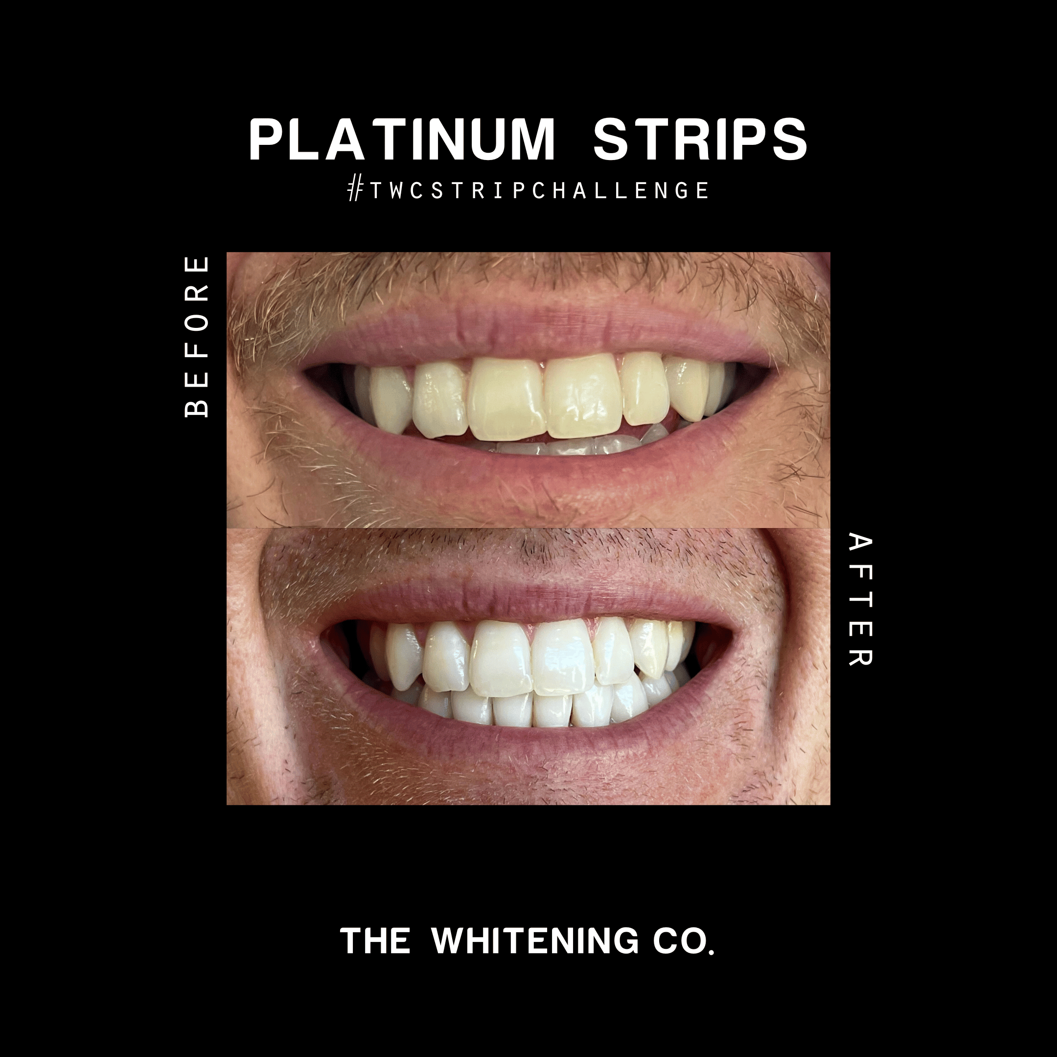 The Whitening Co Platinum Teeth Whitening Strips (14pk)